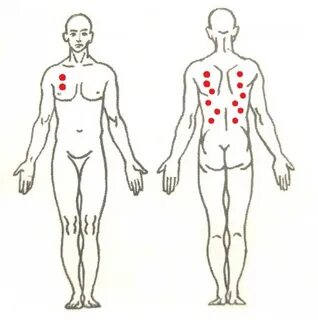 Где поставить банки