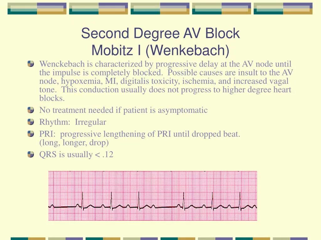 Second degree. Atrioventricular block. Price discrimination examples. Ценовая дискриминация. Third-degree price discrimination.