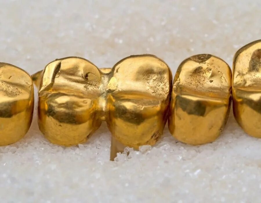 Коронки 850 проба золотые. Золотые коронки 750 пробы. Золото 750 пробы в стоматологии. Золото 900 пробы в стоматологии.