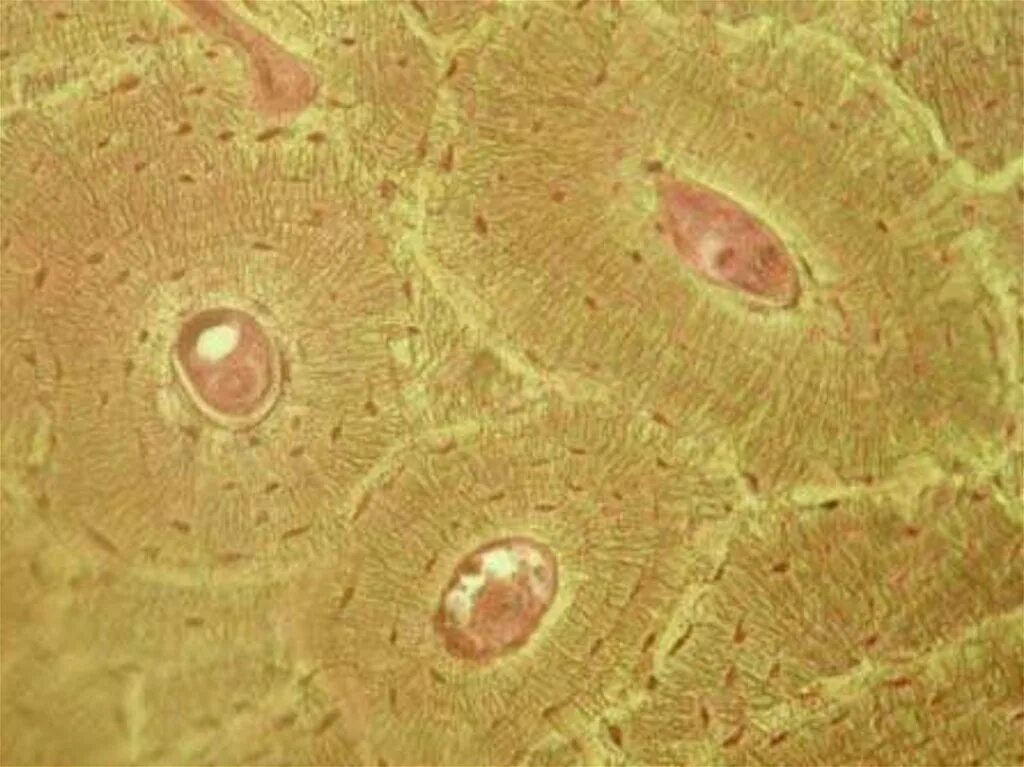 Last week's anatomic structure was a microscopic view of an osteon. The osteon (