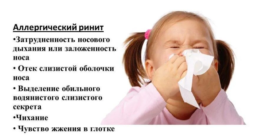 Заложенность носа 2 недели. Аллергический рахит у детей. Аллергический ринит симптомы у детей. Аллергический насморк у ребенка. Аллергический ринит проявления у детей.