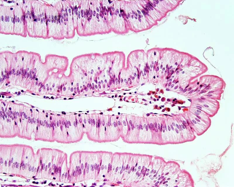 Эпителий тонкой кишки гистология. Эпителий толстой кишки гистология. Кишечная Ворсинка гистология. Эпителий Толстого кишечника гистология.