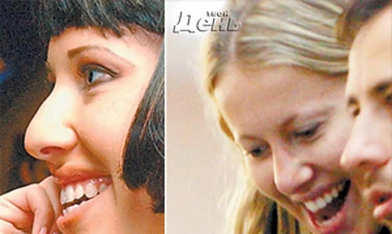 ксения собчак зубы. ксения собчак до пластики. ксения собчак улыбка. ксения собчак. ксения собчак прикус.