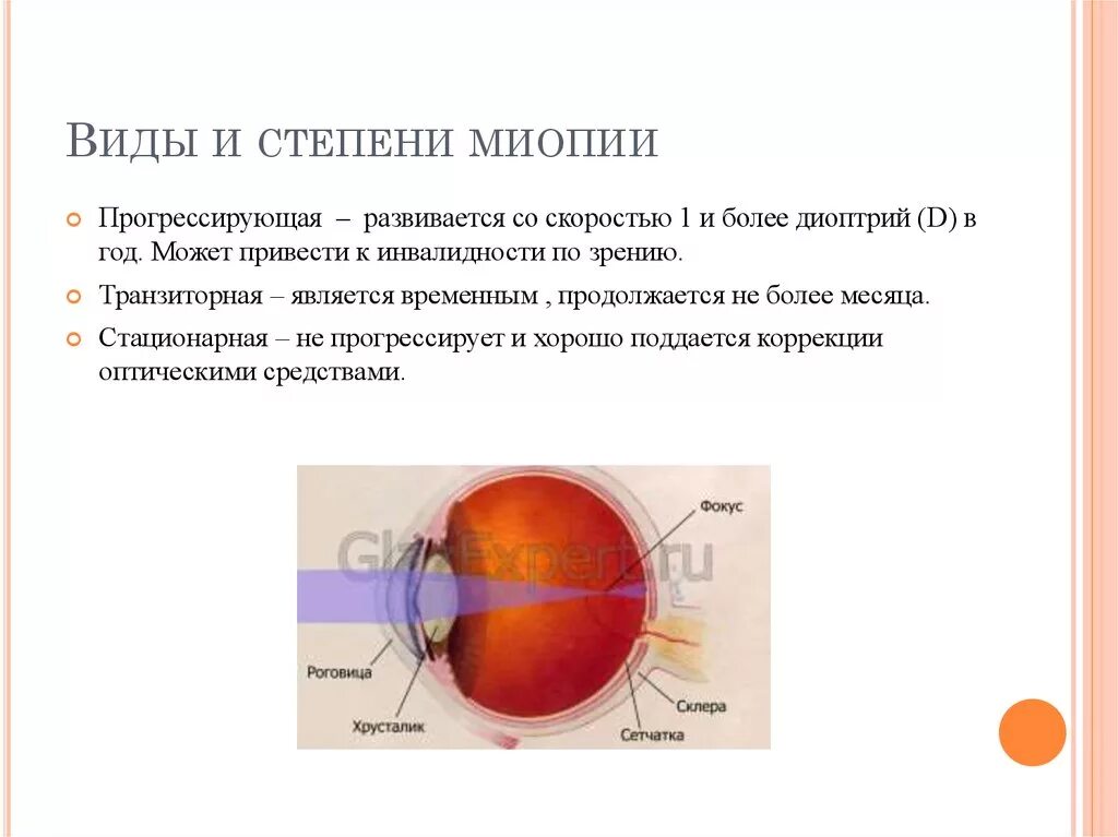 12. Близорукость (миопия).. Прогрессирующая миопия степени. Прогрессирующая миопия высокой степени. Степень миопии -5.5 диоптрий.