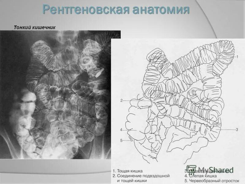 Рентген пассаж