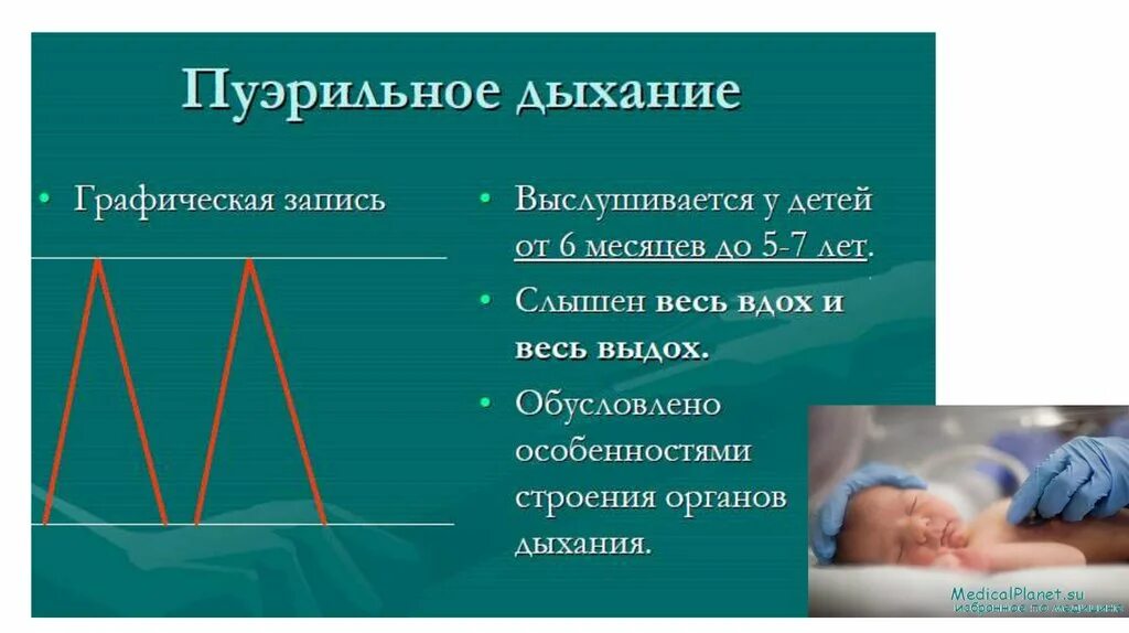 Дыхание у детей пуэрильное до какого возраста. Пуэрильное дыхание у детей. Пуэрильное дыхание у детей обусловлено. Пуэрильное дыхание у детей выслушивается.