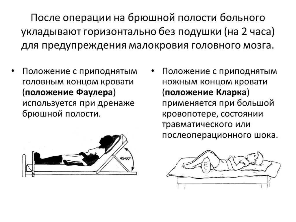 Сколько нужно лежать после операции. Положение больного в кровати в первые 2 часа после операции. реабилитация после операции на органах брюшной полости. послеоперационный период после операции брюшной полости. полостная операция органов брюшной полости.