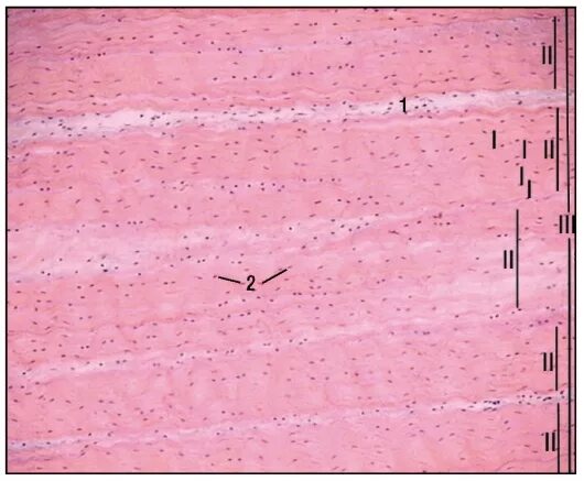Сухожилие в поперечном разрезе гистология. Сухожилие в продольном разрезе препарат. Плотная волокнистая соединительная ткань гистология. Сухожилие препарат гистология. Сухожилие препарат гистология.