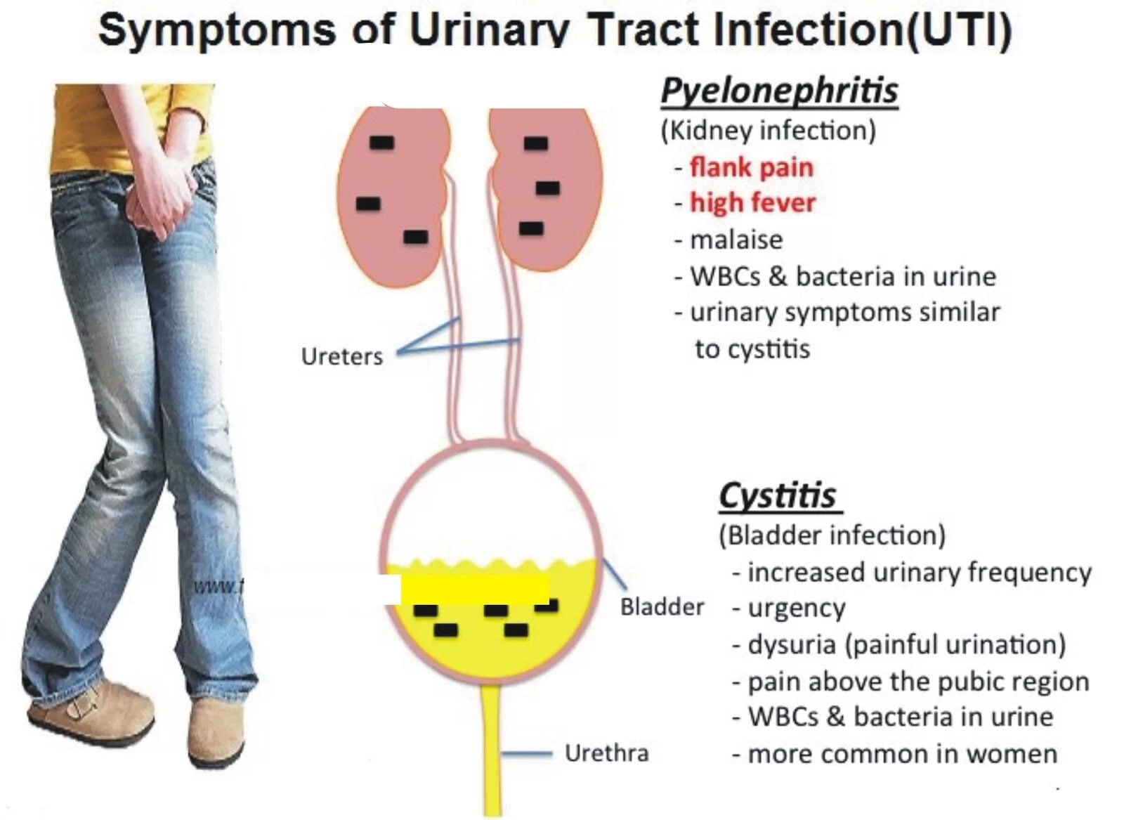 Не могу пописать женщина. Цистит у женщин симптомы. Симптомы цистицистита. Признаки цистита.