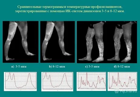 Профили пациентов