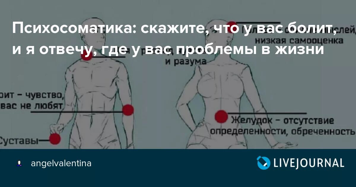 Язвенная болезнь психосоматика. Психосоматика болезней жкт. Психосоматика здоровья психология. Психосоматика термин. Психосоматика болят предплечья.