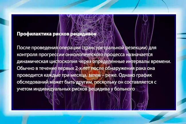 Риски рецидива онкологии. Профилактика рисков. Факторы риска опухоли мочевого пузыря. Высокая вероятность рецидивов.