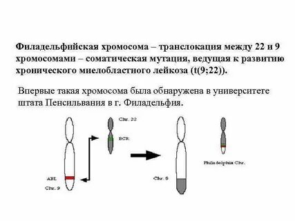 Филадельфийская коляска акт это