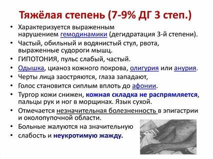 Степени холеры