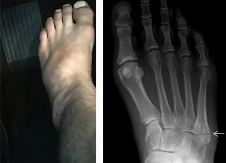 Әдемі жалаңаш орыс қыздарының жеке суреттері