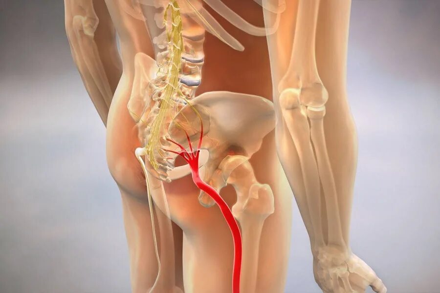 Защемило поясницу отдает в ногу. Защемление седалищного нерва. Защемление седалищного нервв. Седалищный нерв позвоночника. Ишиас воспаление седалищного нерва.