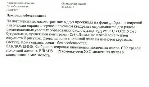 Что значит в заключении маммографии