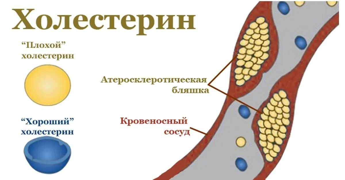 Влияние холестерина в крови. Холестерин. Плохой и хороший холестерин. Хороший холестерин. Плохой или хороший холестерин.