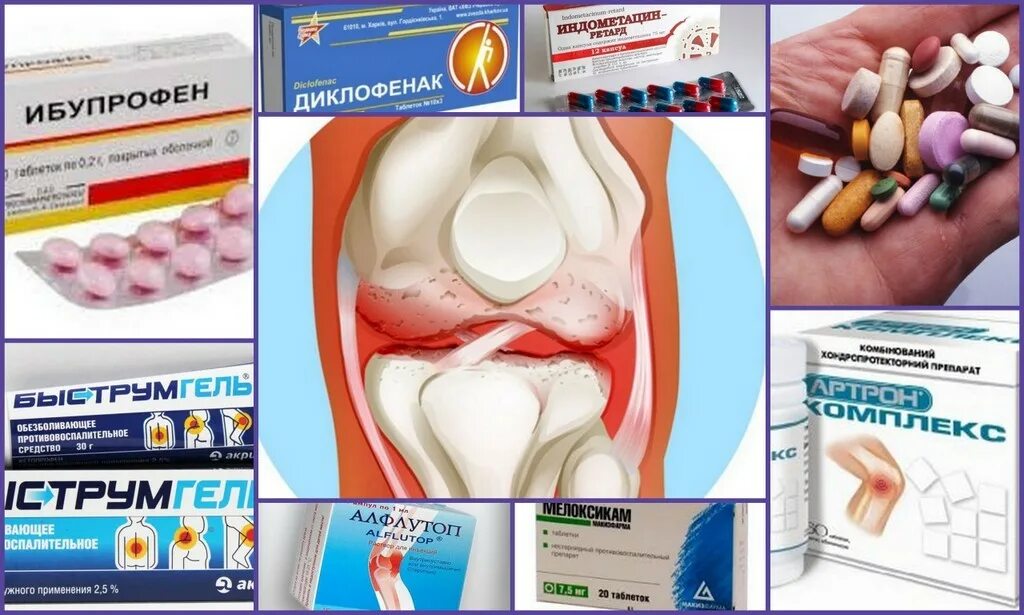 Уколы противовоспалительные и обезболивающие для суставов. Куда ставят обезболивающие. Куда ставят обезболивающие. Обезболивающие уколы при остеохондрозе. Инфильтрационная анестезия стомат.