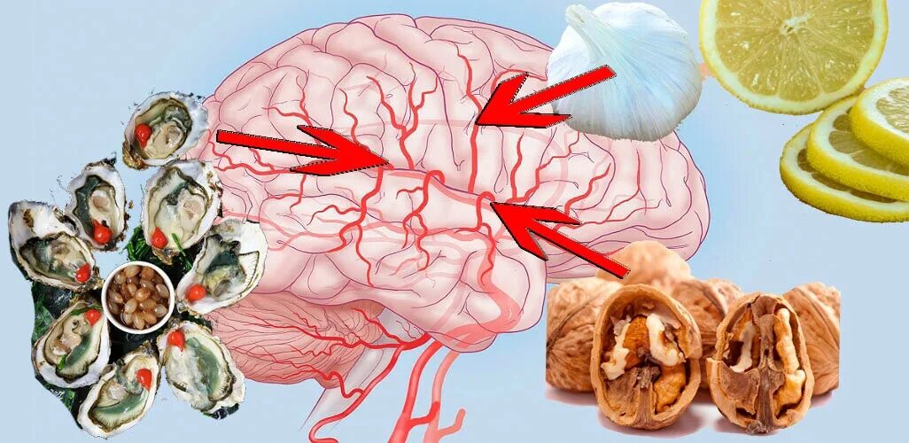 Головного мозга атеросклероз народное средство. Еда для сосудов головного мозга. Продукты для кровоснабжения мозга. Пища улучшающие кровообращение головного мозга. Еда для укрепления сосудов головного мозга.