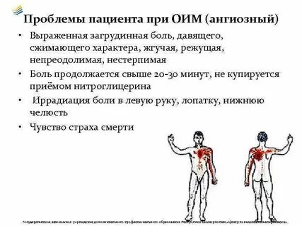 Сжимающая загрудинная боль