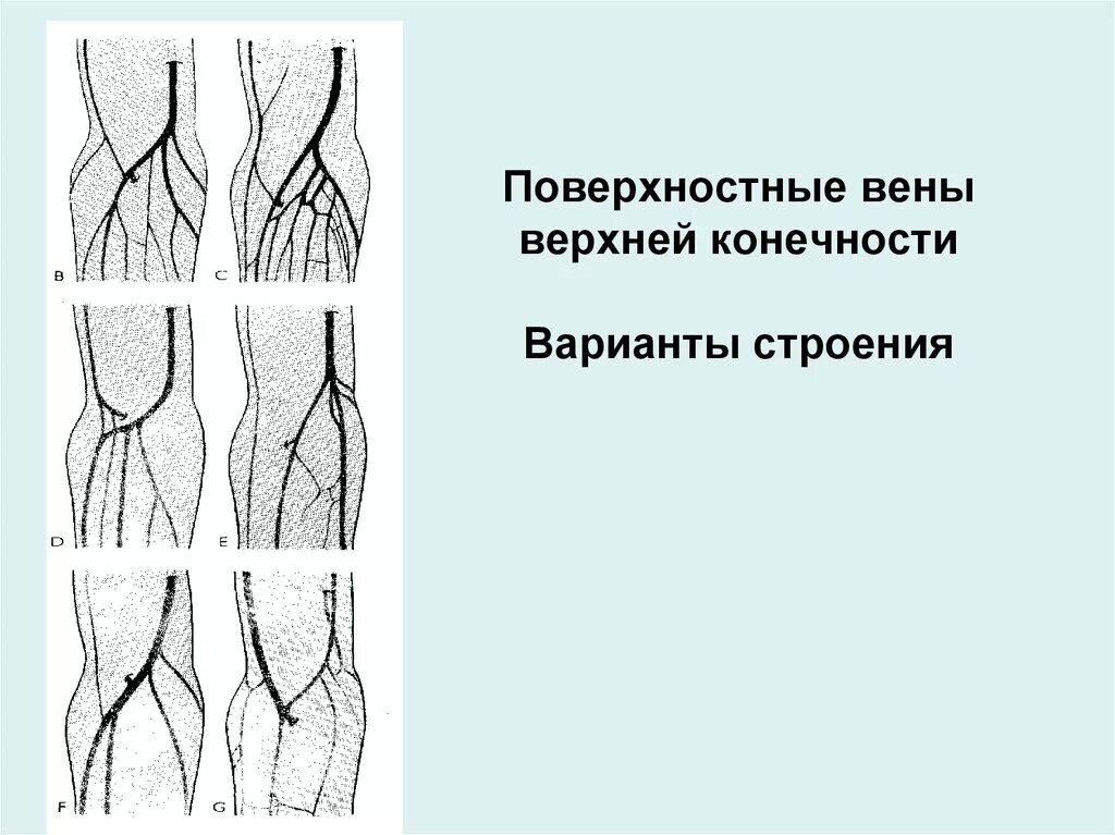 Вены верхней конечности. Срединная кубитальная Вена. Кубитальная Вена верхней конечности. Вены верхних конечностей УЗИ анатомия. Расположение вен на руках для инъекций схема.