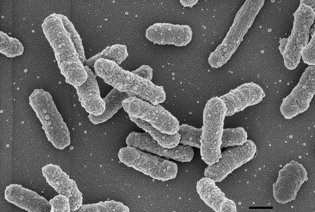 Чума является бактерии. Чума возбудитель (yersinia pestis). бактерия yersinia pestis возбудитель. чумная палочка ( иерсиния). иерсиния псевдотуберкулез.