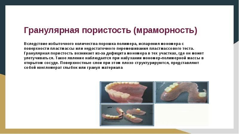 Газовая пористость пластмассы. Пористость протезов. Пористость протезов. Гранулярная пористость протеза. Газовая пористость протеза.