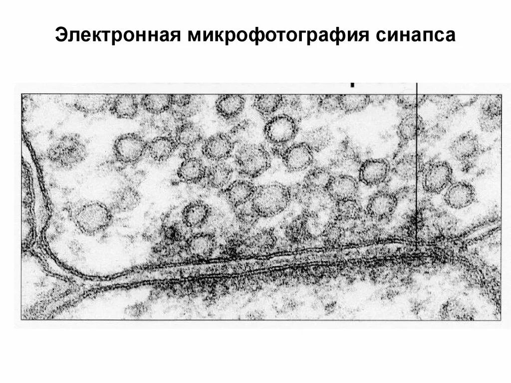 Синапсы гистология. Нервно мышечный синапс микрофотография. электронограмма гистология синапс. электронная микрофотография синапса. синапс гистология препарат.