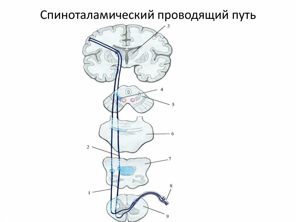 Спинно таламический. Латеральный спиноталамический путь. Передний спиноталамический тракт. Спиноталамический тракт схема. Спиноталамический путь Перекрест.