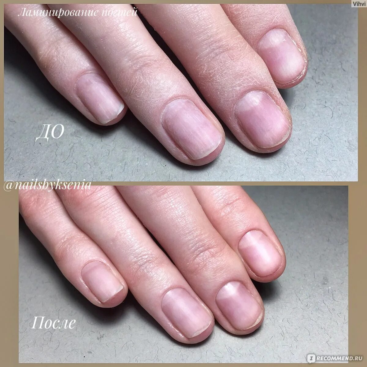 Ногти после геля отзывы. Ламинирование ногтей. Маникюр до и после. Восстановление ногтей до и после.
