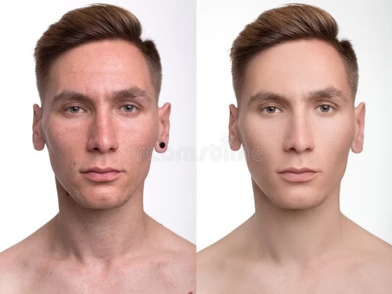 Face comparison