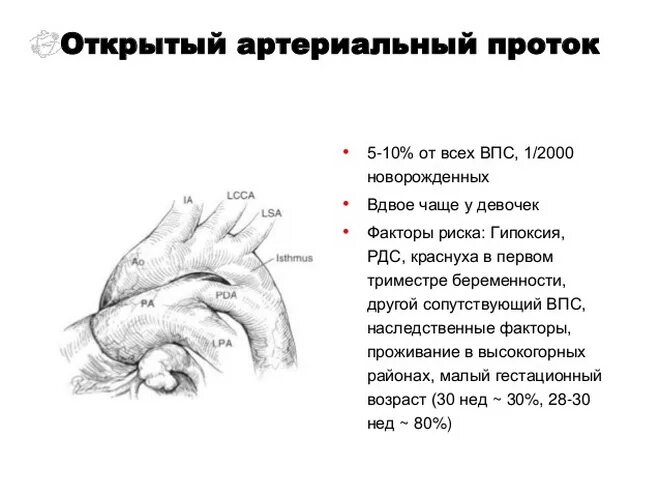 Мкб впс аортальный. Впс открытый артериальный проток по мкб 10. мкб 10 открытый артериальный проток код у детей. порок сердца код по мкб 10. врожденный порок сердца код по мкб 10.