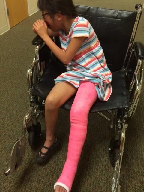 Double Leg Cast wheelchair. Long Leg Cast wheelchair. Leg Cast Boot Kids. Cast leg