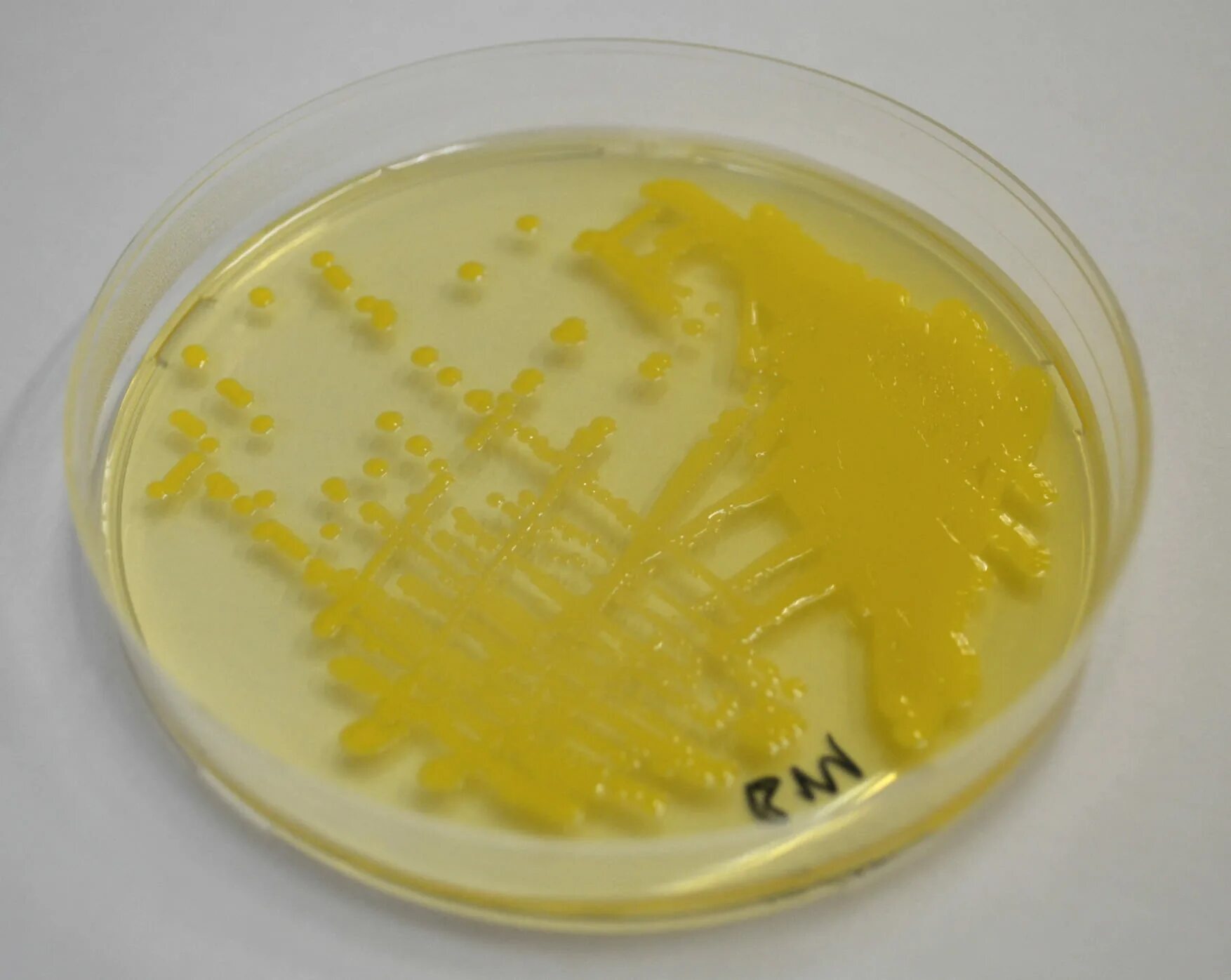 Можно ли вылечить золотистый. S. aureus золотистый стафилококк. staphylococcus aureus (atcc 29213). пигмент золотистого стафилококка.