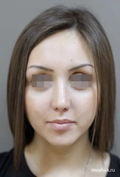 романчук алексей леонидович владивосток. сергей мошак. пластическая хирургия владивосток. пластическая хирургия владивосток. приходько андрей георгиевич врач.