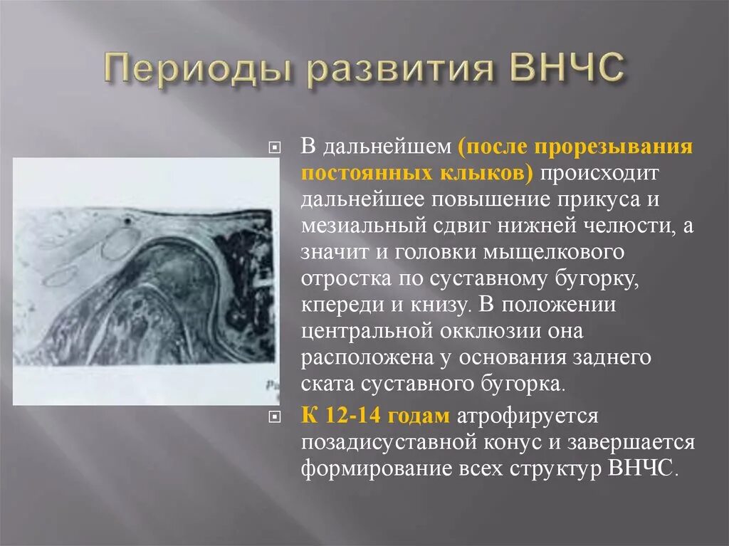 Код мкб височно нижнечелюстного сустава. Формирование височно-нижнечелюстного сустава. формирование внчс в периоды формирования.