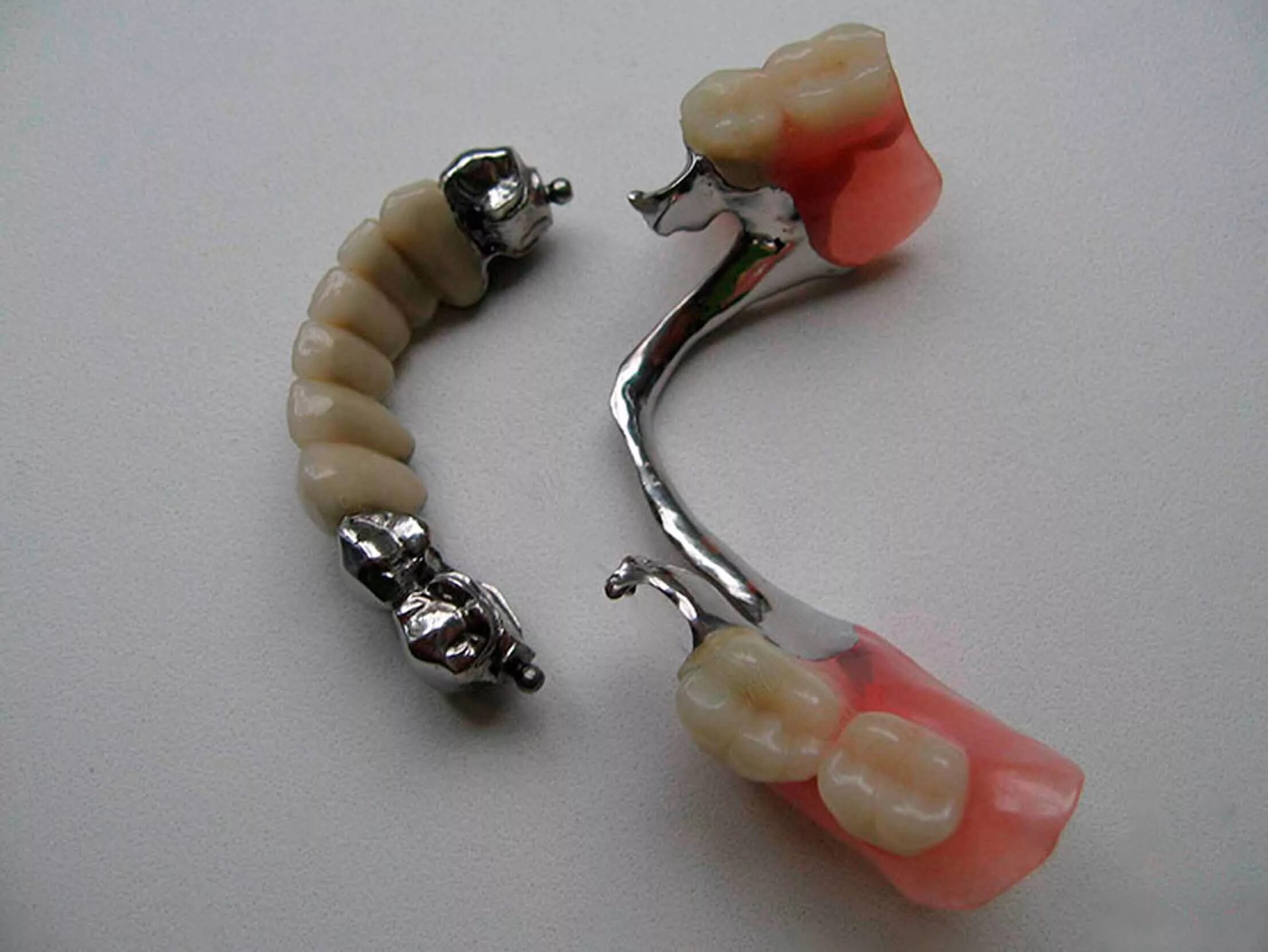 бюгельный протез а16. бюгельный протез на замках мк-1. замковый съемный протез. бюгельный протез (2-3 кламмера). 002.