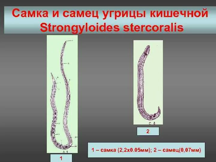 Стронгилоидоз (кишечная угрица). Угрица кишечная строение. Угрица кишечная морфология. Рабдитовидная личинка кишечной угрицы.