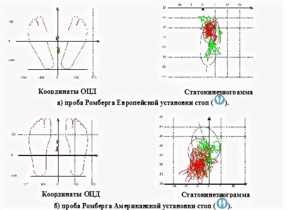 Использование пробы ромберга для определения координации. Пробы ромберга тест. Исследование функции равновесия. Вестибулярная устойчивость (проба ромберга) (с). Устойчивость в позе ромберга.