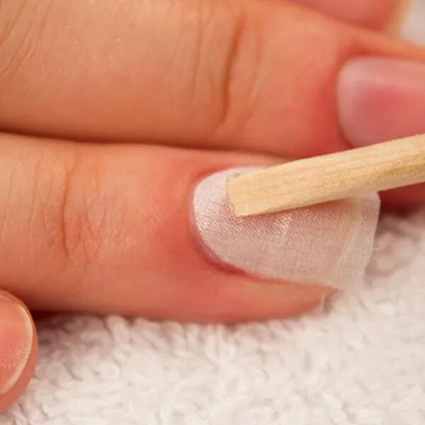 сломать ногти во сне к чему. сломанный ноготь во сне. ногти в ужасном состоянии. онихолизис синегнойная. сломанный ноготь во сне.