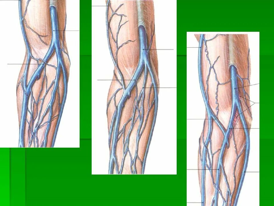Кубитальная Вена верхней конечности. Кубитальная локтевая Вена. Срединная локтевая Вена. Вены верхней конечности топографическая анатомия.