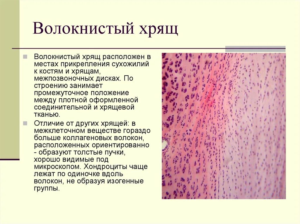 Коллагено-волокнистый хрящ. Волокнистая хрящевая ткань строение. Волокнистый хрящ строение. Волокнистая хрящевая ткань надхрящница.