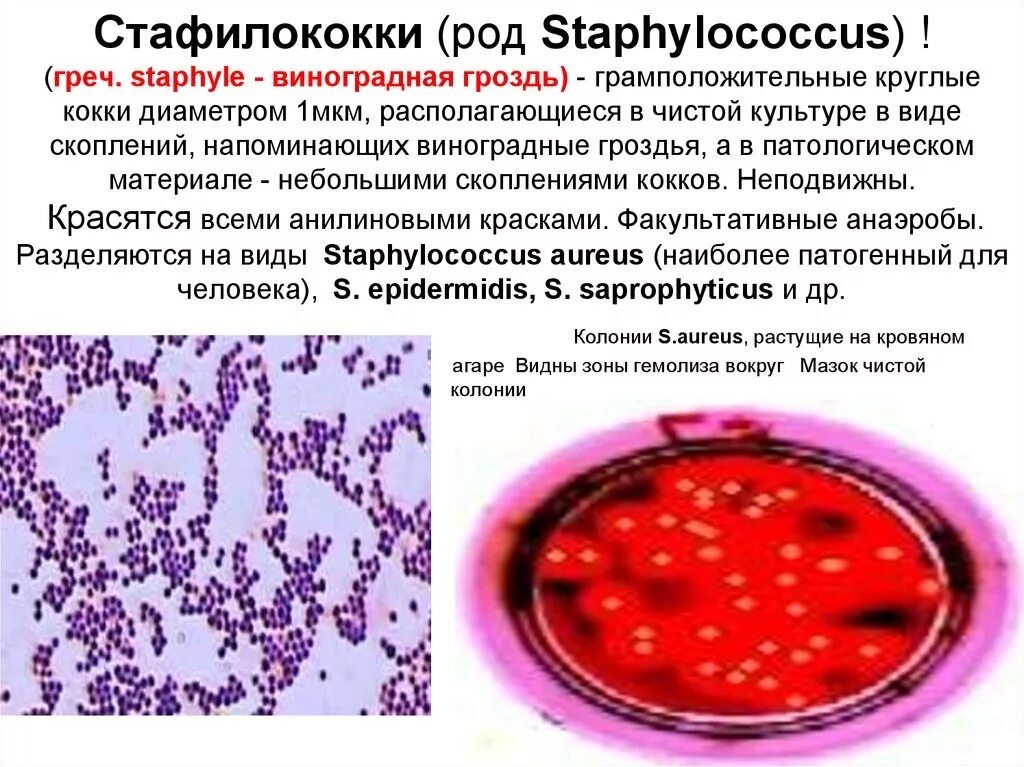 Грамположительные кокки микробиология. Грамположительные кокки в виде гроздьев винограда. Виноградная гроздь грамположительные кокки стафилококки. Грамположительные кокки убивка.