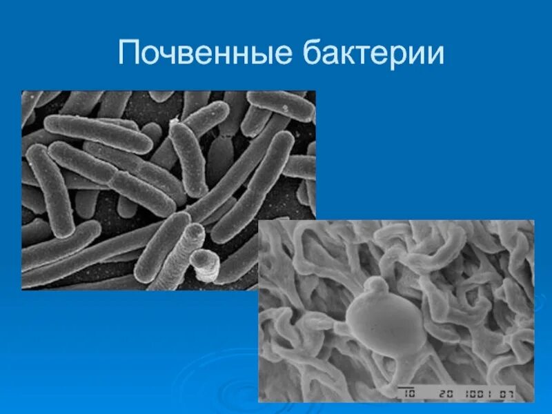 Почвенные бактерии это. Почвенные бактерии. Почвенные бактерии бактерии. Патогенные почвенные бактерии. Микроорганизмы в почве.