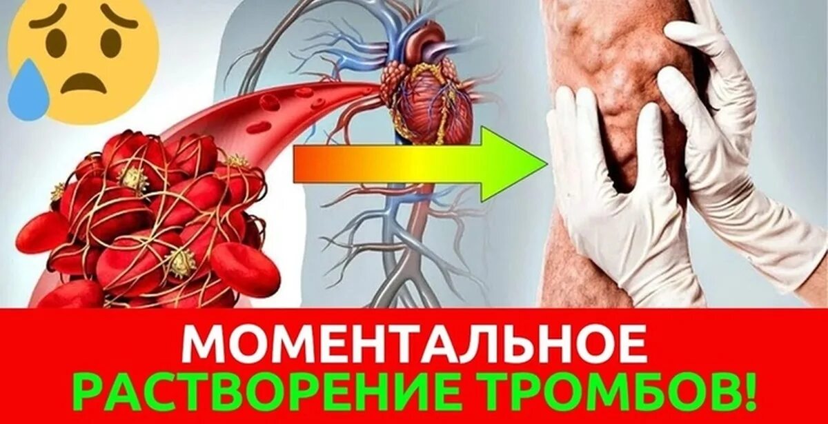 Что делать если обнаружили тромб. Препараты растворяющие тромбы.
