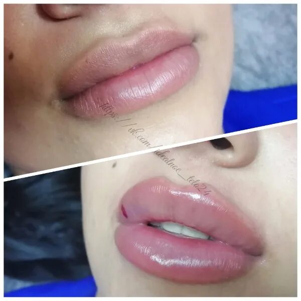 Лук купидона губы. Губы арка. Губы арка. Форма губ арка купидона. Прямые губы.