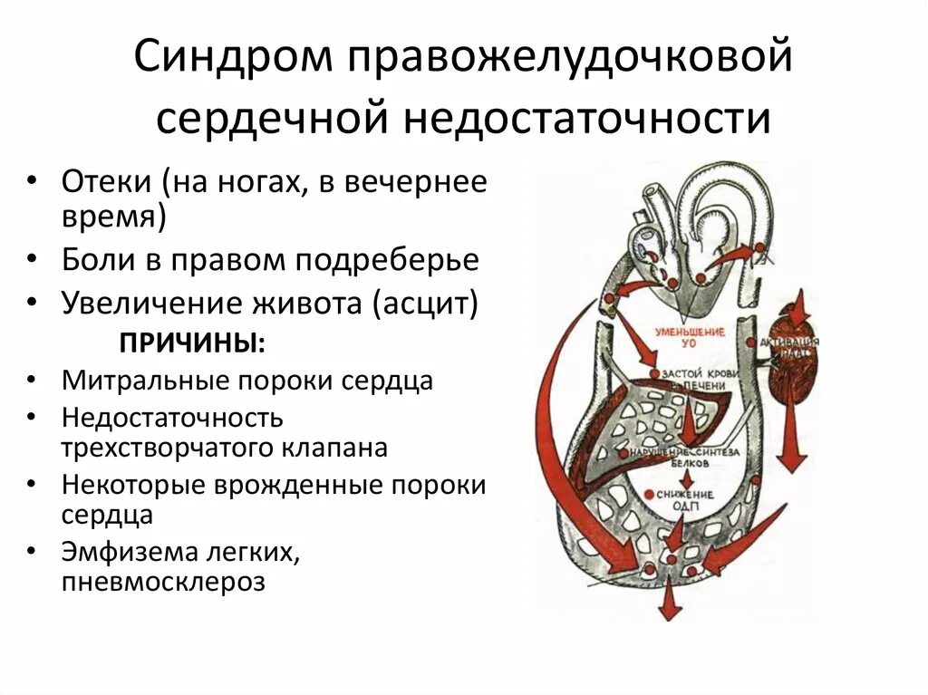 Признаки сердечной деятельности. Симптомы острой правожелудочковой недостаточности. Клинические симптомы правожелудочковой недостаточности. Синдром хронической правожелудочковой сердечной недостаточности. Клинические проявления правожелудочковой сердечной недостаточности.