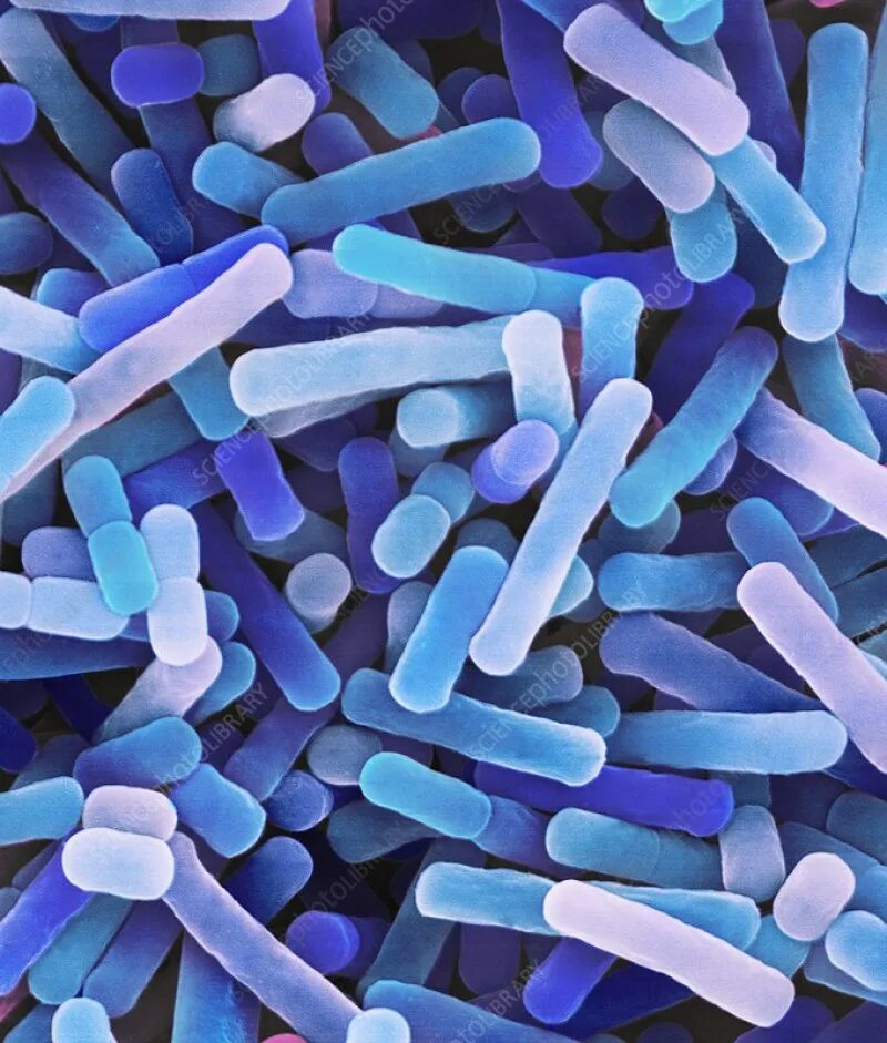 Болгарская палочка lactobacillus bulgaricus. Термофильные молочнокислые бактерии. Молочнокислый стрептококк. Lactobacillus rhamnosus под микроскопом. Термофильные молочнокислые стрептококки.