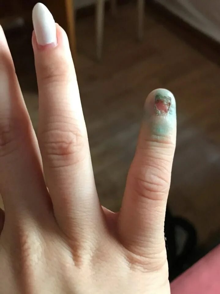 Ногти без маникюра неухоженные. Сквоовал форма ногтей опил. Смешной маникюр. Шутки про маникюр. Опил ногтевой пластины.
